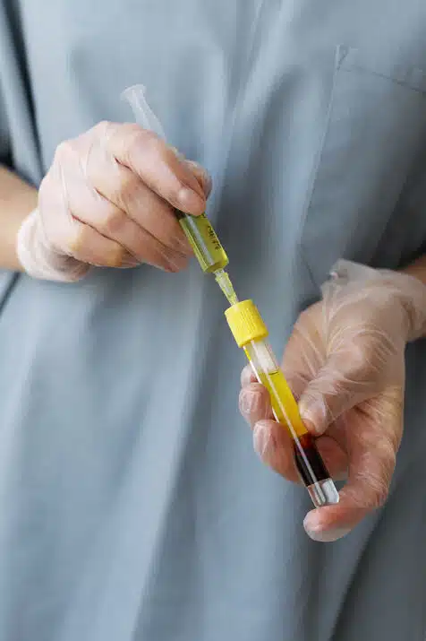 female nurse injecting testosterone through iv